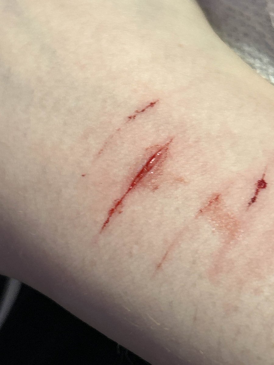 imsicxkssimon's tweet photo. hey i found it

sfx makeup ai generated not real🥀 https://t.co/zeeHkDnLSA