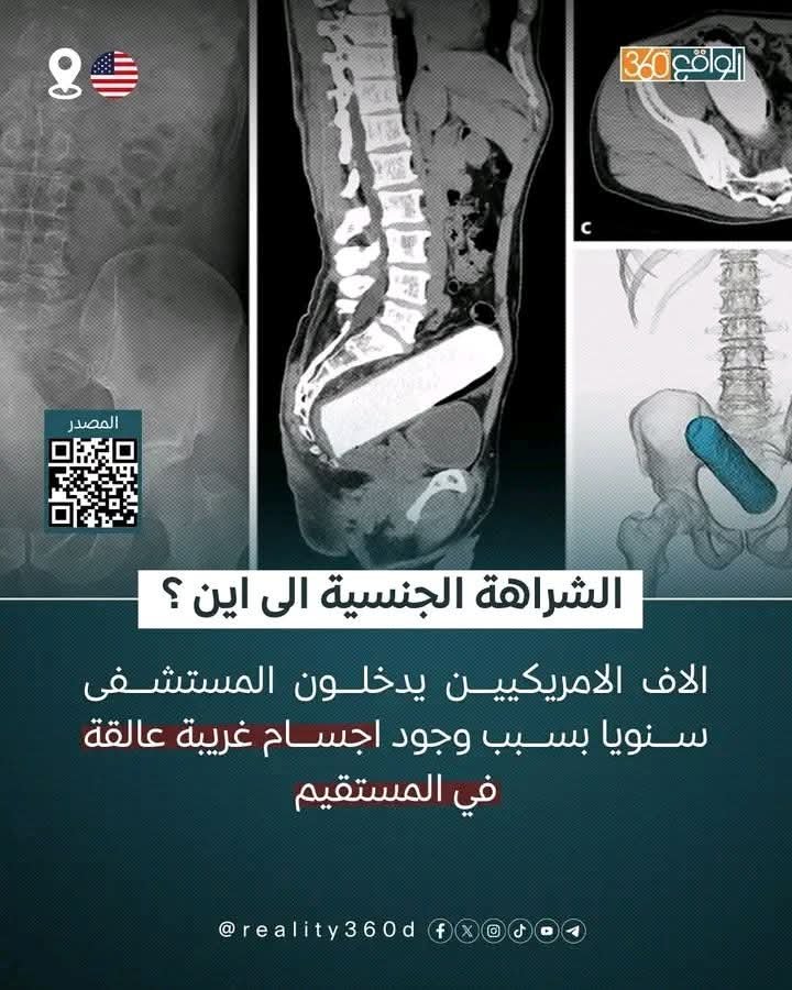 a7mad_elsa3ed's tweet photo. الأمم التي ضحكت من جهلنا 👇 https://t.co/VcddPR2G65