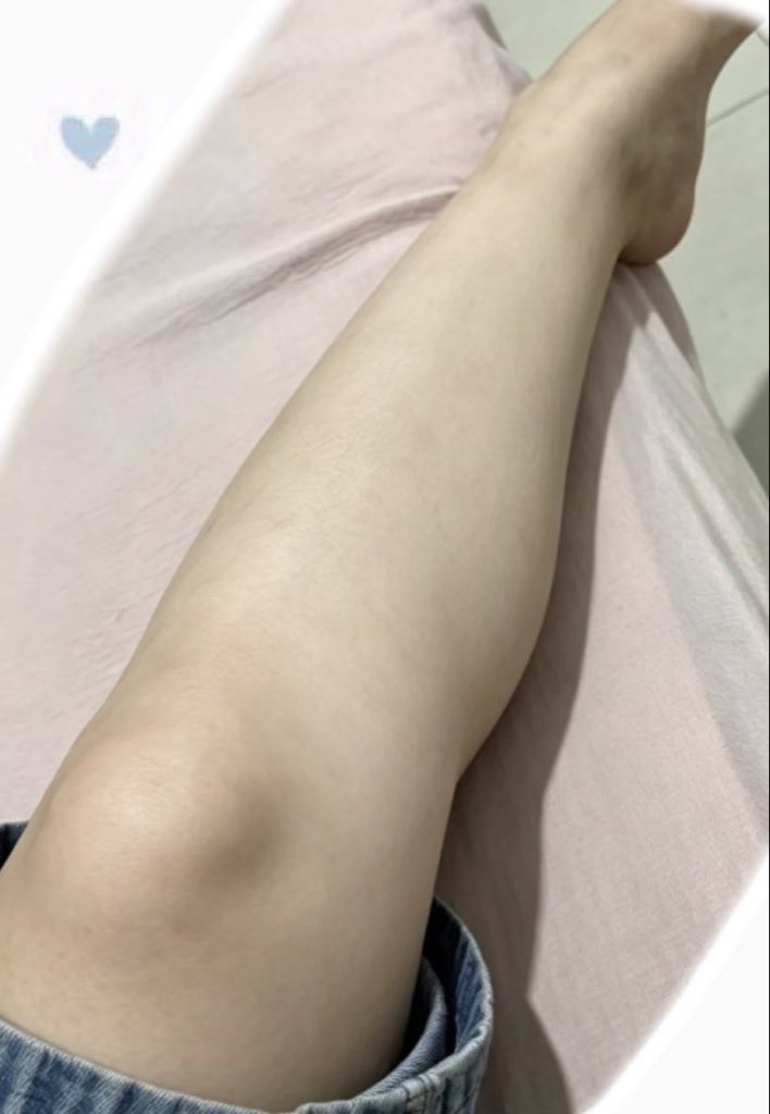 minacosme__'s tweet photo. このスクラブは足の傷あとにも効く。 https://t.co/Elb74qZVck
