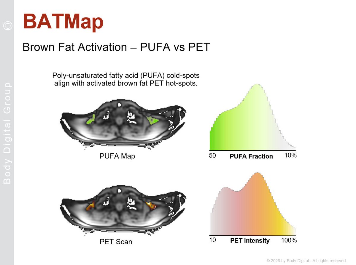 bodymapdigital's tweet photo. #BodyDigital #BATMap: Do you have active brown fat?🔥 In "browned” #fat, PET scan hotspots match #MRI poly-unsaturated fatty acid (PUFA) coldspots — suggesting a transition from PUFA enrichment to depletion as brown fat becomes fully active. https://t.co/J0OIuTRI91