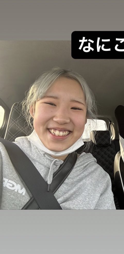 ranrankobito's tweet photo. まじで天才アップデートすぎておもろい
ほとんど無加工です
1枚目18さい無整形
2.3枚目なう
ほぼ1.5年とかで仕上げたスピードの速さおそるべしにゃーーかわいーのあ https://t.co/gKCv331SVD