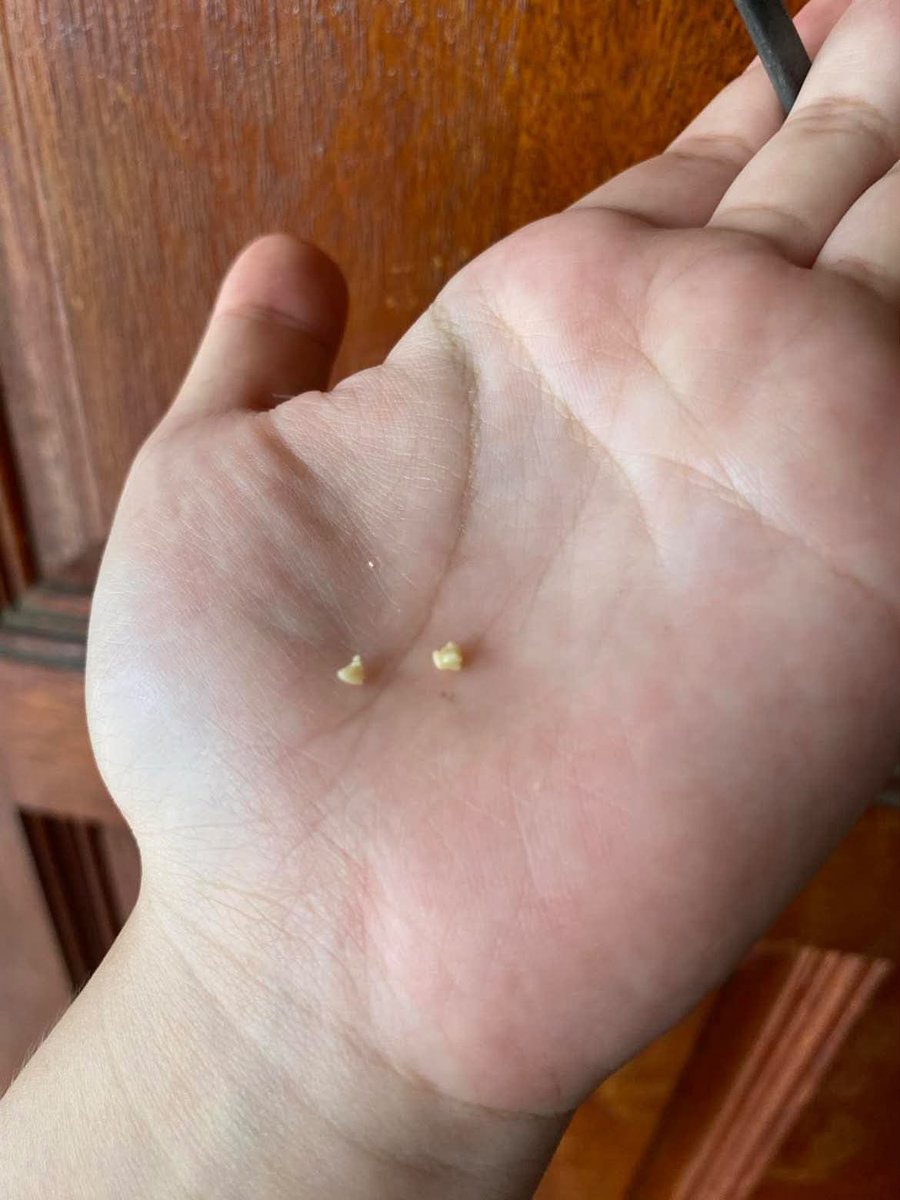 venggk's tweet photo. Saran dokter: ganti pasta gigi dengan Hydroxylapatite.
Hasilnya: plak ogah nempel, karang gigi memudar, napas lebih segar.
Ternyata sesederhana itu. 🥹 https://t.co/N4JcGL0J7Q