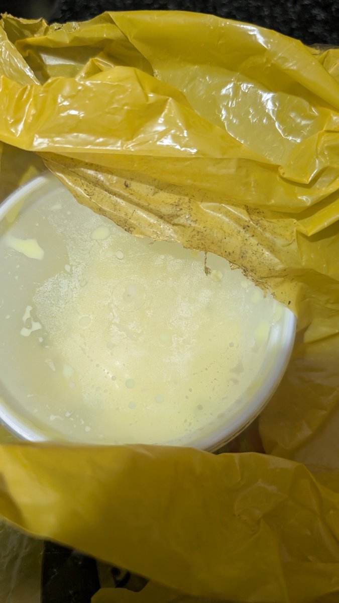 Ind87's tweet photo. @SwiggyCares received dirty and incorrect food instead of hygienic food. Refer to attached pictures. Only refund was provided for incorrect one. No min hygiene standards. Order# 249371490123497. https://t.co/sjL5g95kl0