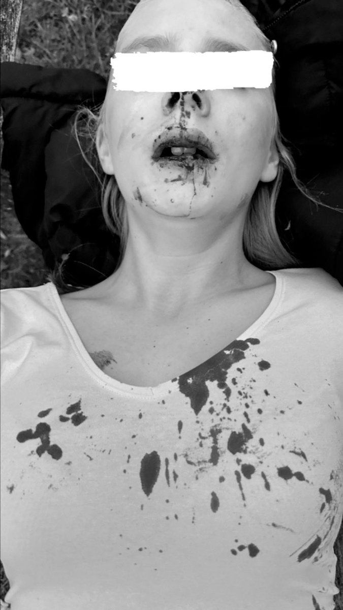 ChRichter's tweet photo. Heute ist es ein Jahr her, dass ich einen Anruf bekam, den keine Mama bekommen sollte. 
Eine Freundin meiner Tochter war am Telefon und sagte mir, mein Kind sei gerade brutal zusammengeschlagen worden. 
Im Hintergrund hörte ich mein Kind schluchzen und immer wieder „Meine Mama, meine Mama“ sagen. Als ich ankam, lag sie blutüberströmt auf einer Bank. Die Täterin hatte sie zu Boden gebracht und so heftig auf sie eingeschlagen und eingetreten, dass sie sich dabei selbst die Hand brach. Meine Tochter kam mit aufgeplatzten Lippen, einem Schädel-Hirn-Trauma und einem Bauchtrauma ins Krankenhaus.

Was dann folgte würde mir kein Mensch glauben, wenn ich nicht glücklicherweise alles Schriftlich hätte. 
Mein Kind schläft schlecht, weint viel, zieht sich zurück. Etwa einmal pro Woche muss ich sie aus der Schule abholen, weil sie eine Panikattacke hat oder einfach nicht mehr aufhören kann zu weinen vorher war sie frech, selbstbewusst und fröhlich… 
Sie ist in Therapie, aber draußen fühlt sie sich bis heute nur sicher, wenn ich dabei bin oder mindestens 2 ihrer Freunde. 
Ich fahre sie zu Verabredungen oder Freunde holen sie ab. Wenn sie sich doch mal allein rausgetraut hat, wurde sie wieder von der Täterin belästigt. 
Und kommenden Freitag soll sie von ihrer jetzigen Schule aus zu einer Veranstaltung zur Berufsausbildung an ihre alte Schule. Dort wurde sie zwei Jahre lang gemobbt, und ihre Schlägerin soll an derselben Veranstaltung teilnehmen, weil sie dort auf der Schule im selben Jahrgang ist. 
Mein Kind wird da nicht hingehen. Aber es macht mich so wütend, dass sie deshalb auf diese Veranstaltung verzichten muss. Ich habe damals schon erlebt, wie wenig sie dort geschützt wurde und wie sehr aus meiner Sicht Täter geschützt wurden, gerade auch wenn sie nicht deutsch waren. Warum sollte ich darauf vertrauen, dass es diesmal anders läuft? Begleiten kann ich sie nicht mal, weil ich dort Hausverbot habe, nachdem ich den Direktor mehrfach bei den Behörden angezeigt habe.

Kommenden Monat ist endlich die erste Verhandlung vor dem Jugendstrafgericht. Die Zivilklage steht auch noch aus aber ich habe einen super Anwalt an meiner Seite, der die ganze Zeit für mich da ist. 
Dieses Wochenende ist meine Tochter zum Glück bei einer guten Freundin von mir und ihren Kindern. Die Kinder kennen sich, seit sie klein sind, und ich hoffe, sie kann dort ein bisschen abschalten. Nach der Verhandlung wollten wir in den Herbstferien wieder an die Ostsee fahren. Ob das bei den Benzinpreisen klappt, weiß ich nicht. Es ist ohnehin schon schwer genug, das alles irgendwie aufzufangen. Und dann muss ich auch noch zusehen, wie mein Kind wegen der Angst vor ihrer Schlägerin auf ganz normale Dinge verzichten muss. Das macht mich einfach nur noch fassungslos.

Unsere Kinder sind nicht mehr sicher in diesem Land…