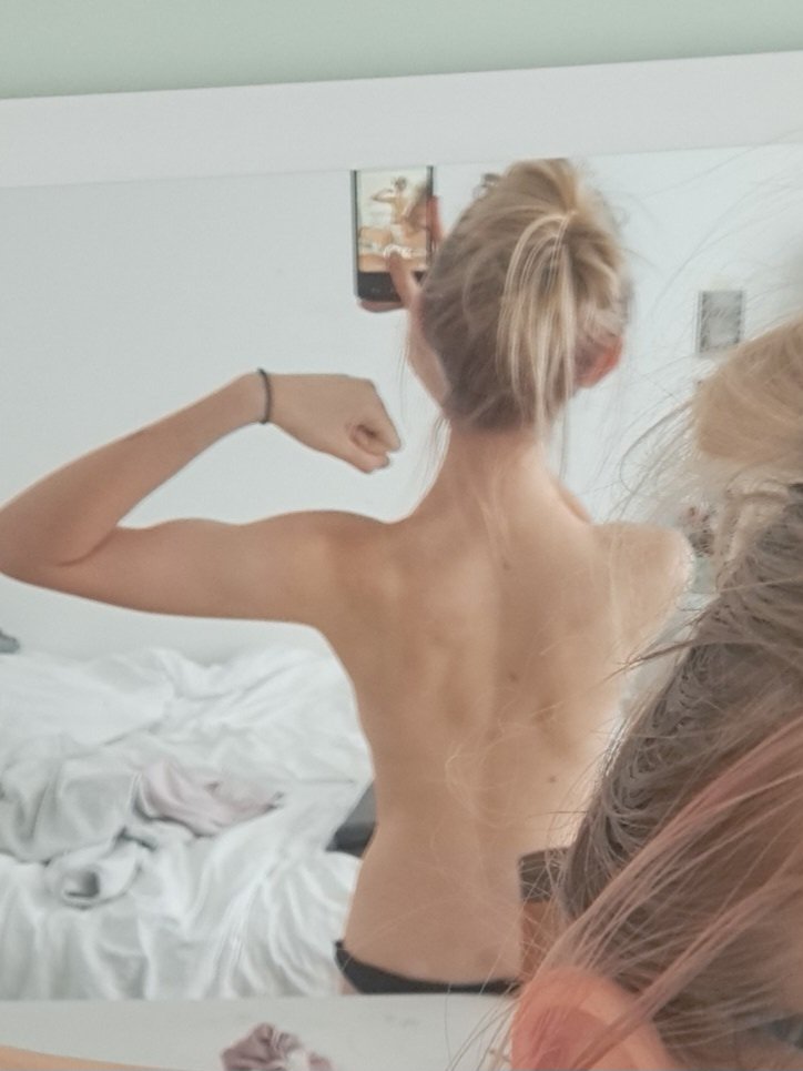 vampirexic33176's tweet photo. bmi guesses would be greatly appreciated ive been binging a ton lately and im very scared https://t.co/em7rYaVWxD