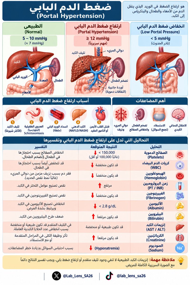 Lab_Lens_SA26's tweet photo. 🧵 ضغط الدم البابي | Portal Hypertension

ارتفاع الضغط في الوريد البابي غالبًا ينتج عن زيادة مقاومة تدفق الدم عبر الكبد.

أبرز الأسباب:
• تليف الكبد
• انسداد الوريد البابي
• البلهارسيا

🔬 مخبريًا قد نلاحظ:
↓ Platelets
↓ Albumin
↑ PT/INR
↑ Bilirubin

وقد تظهر مضاعفات مثل تضخم الطحال، الاستسقاء ودوالي المريء.

📌 التفاصيل والتفسير في الإنفوجرافيك 👇

🔗 المصادر الرسمية:
AASLD:
https://t.co/wOI8yU87CK

WHO – Schistosomiasis:
https://t.co/7h4z1lPsEZ

#عدسة_المختبر #المختبرات_الطبية