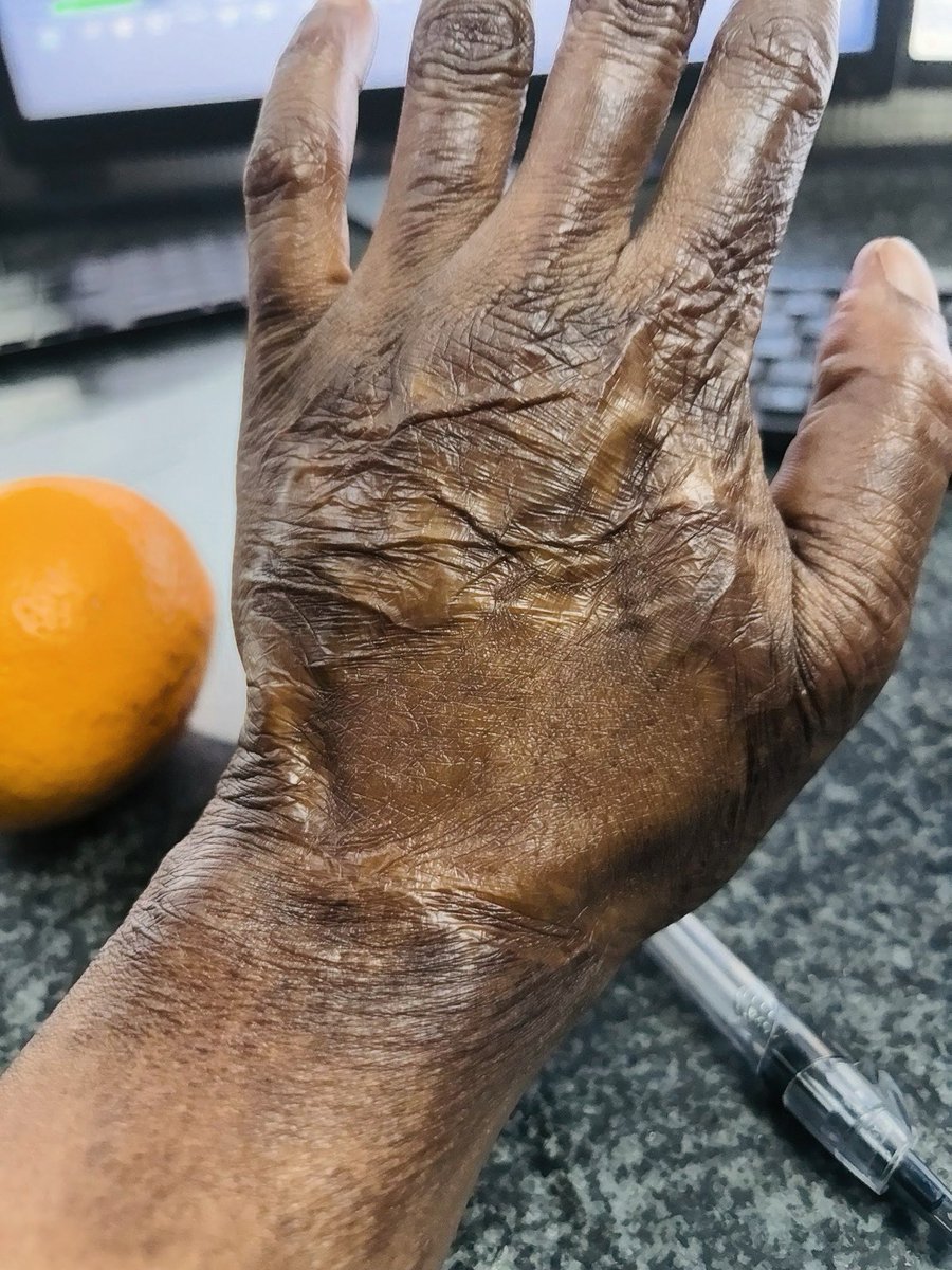 Misst_Thembs's tweet photo. Hands of A  survivor https://t.co/UnFLuW3nSn