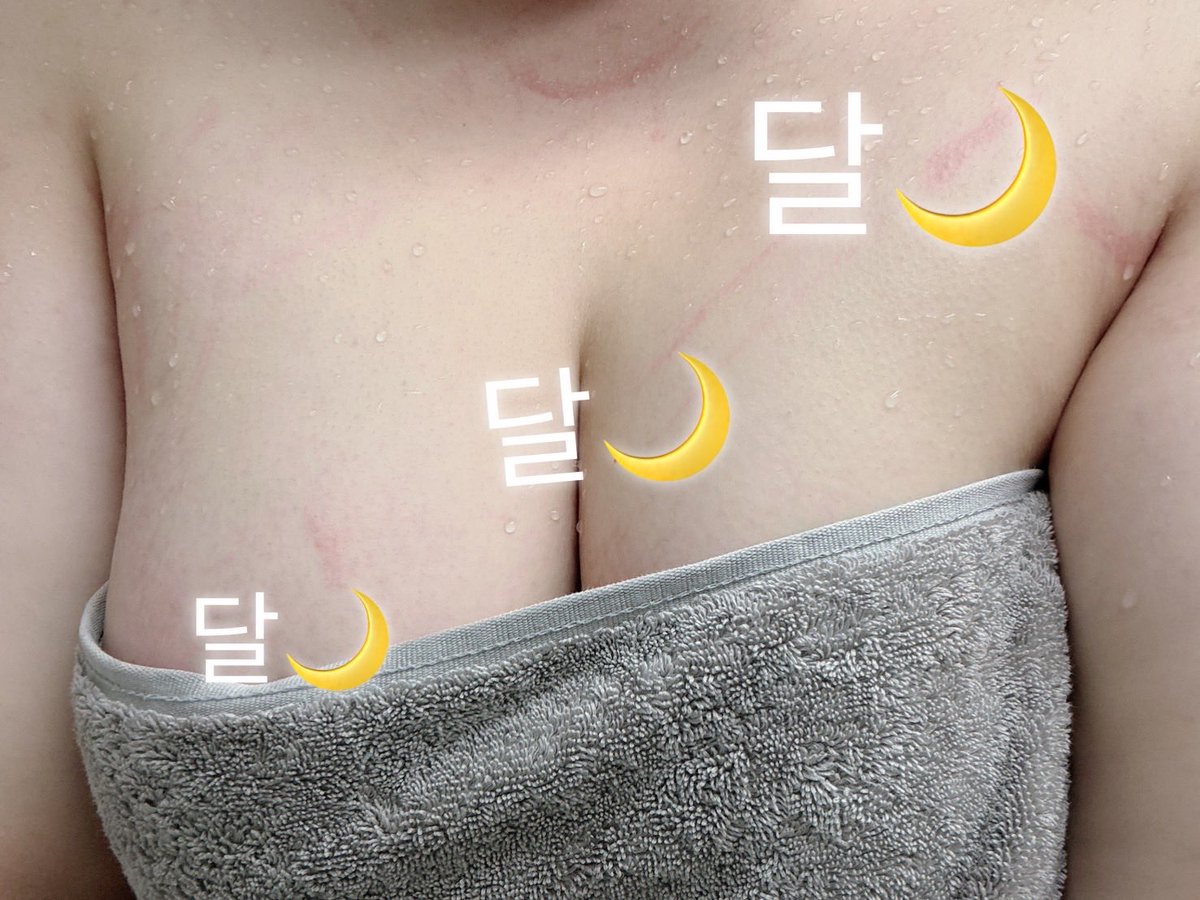 af72ea88c810398's tweet photo. 목요팅해여!💪🏻
#bbw #뚱뚱 #뚱녀 https://t.co/EZAjyTxlGu
