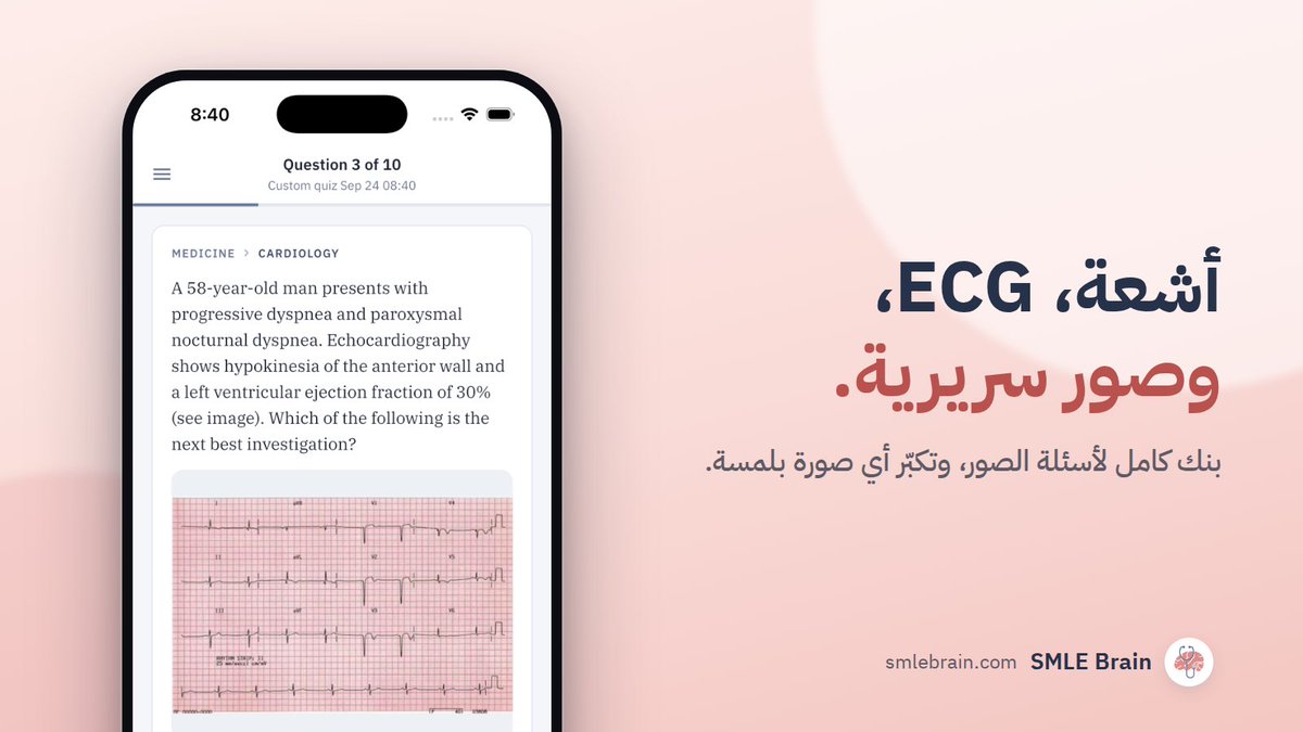 smlebrain's tweet photo. اقوى تطبيق لتجهيز SMLE ❤️‍🔥🧠🩺

📝اسالة MG/GB كامله منقسمة على التخصص والمادة بدون اشتراك

⚡️فلتر للتخصص، المادة، الشهر عشان تقوي نفسك على نقاط الضعف

🩻تدريب على اسئلة الصور بطريقة سريعة وسهلة وواضحة

🔎 بحث اسالة

متوفر على الايفون والايباد والاندرويد
📲 https://t.co/igHci4Y4Rd https://t.co/vou2OHMBpR