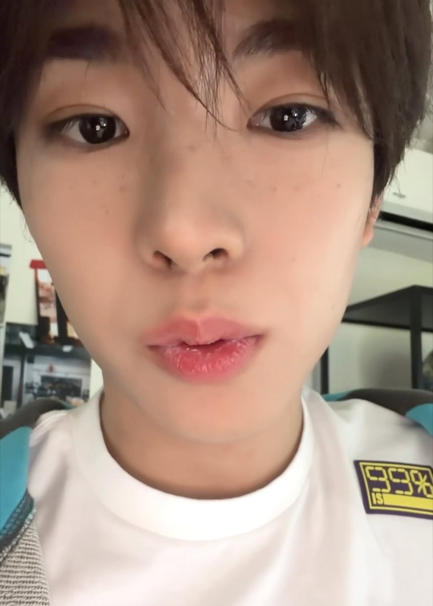 o2yushi's tweet photo. 똥강아디 쌍꺼풀 폭식이다 https://t.co/CJEaxOVA3U