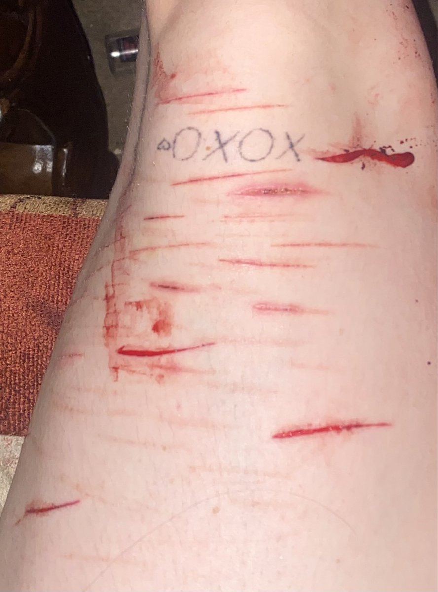 OzzieeBeloved's tweet photo. ALL SFX MAKEUP AND FAKE DW, ITS ALL FAKE. #FAKEMAKEUP #SFX #owchietwt #slittwt #FAKE https://t.co/HHuPEEdUBx