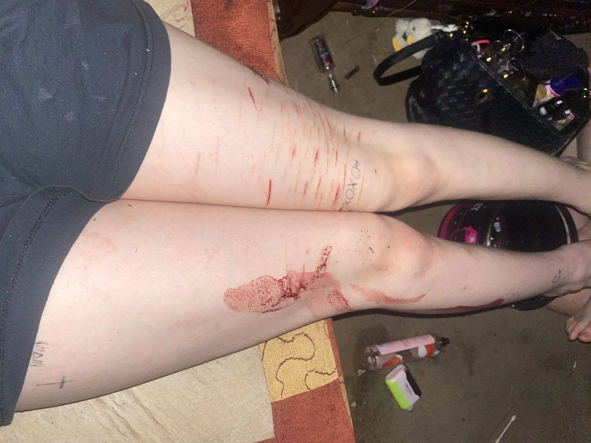 OzzieeBeloved's tweet photo. ALL SFX MAKEUP AND FAKE DW, ITS ALL FAKE. #FAKEMAKEUP #SFX #owchietwt #slittwt #FAKE https://t.co/HHuPEEdUBx