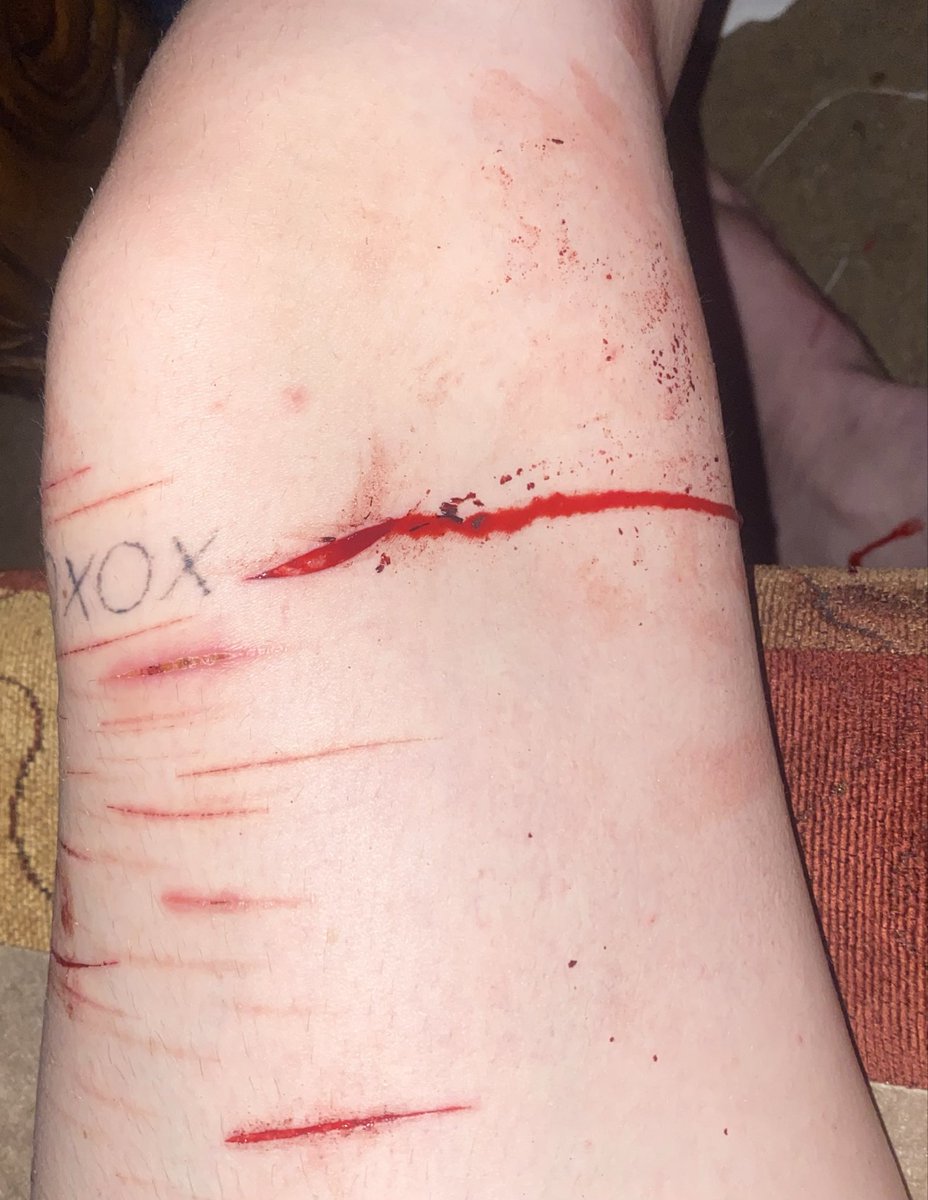OzzieeBeloved's tweet photo. ALL SFX MAKEUP AND FAKE DW, ITS ALL FAKE. #FAKEMAKEUP #SFX #owchietwt #slittwt #FAKE https://t.co/HHuPEEdUBx
