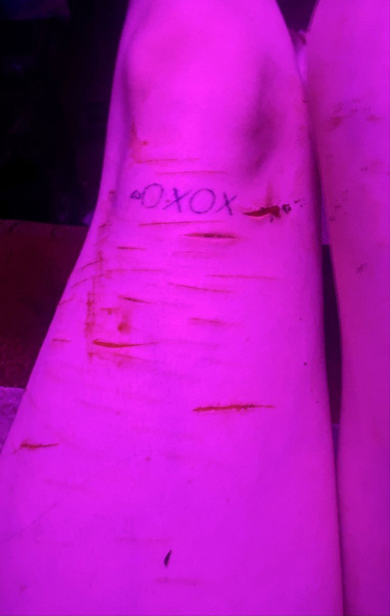 OzzieeBeloved's tweet photo. ALL SFX MAKEUP AND FAKE DW, ITS ALL FAKE. #FAKEMAKEUP #SFX #owchietwt #slittwt #FAKE https://t.co/HHuPEEdUBx
