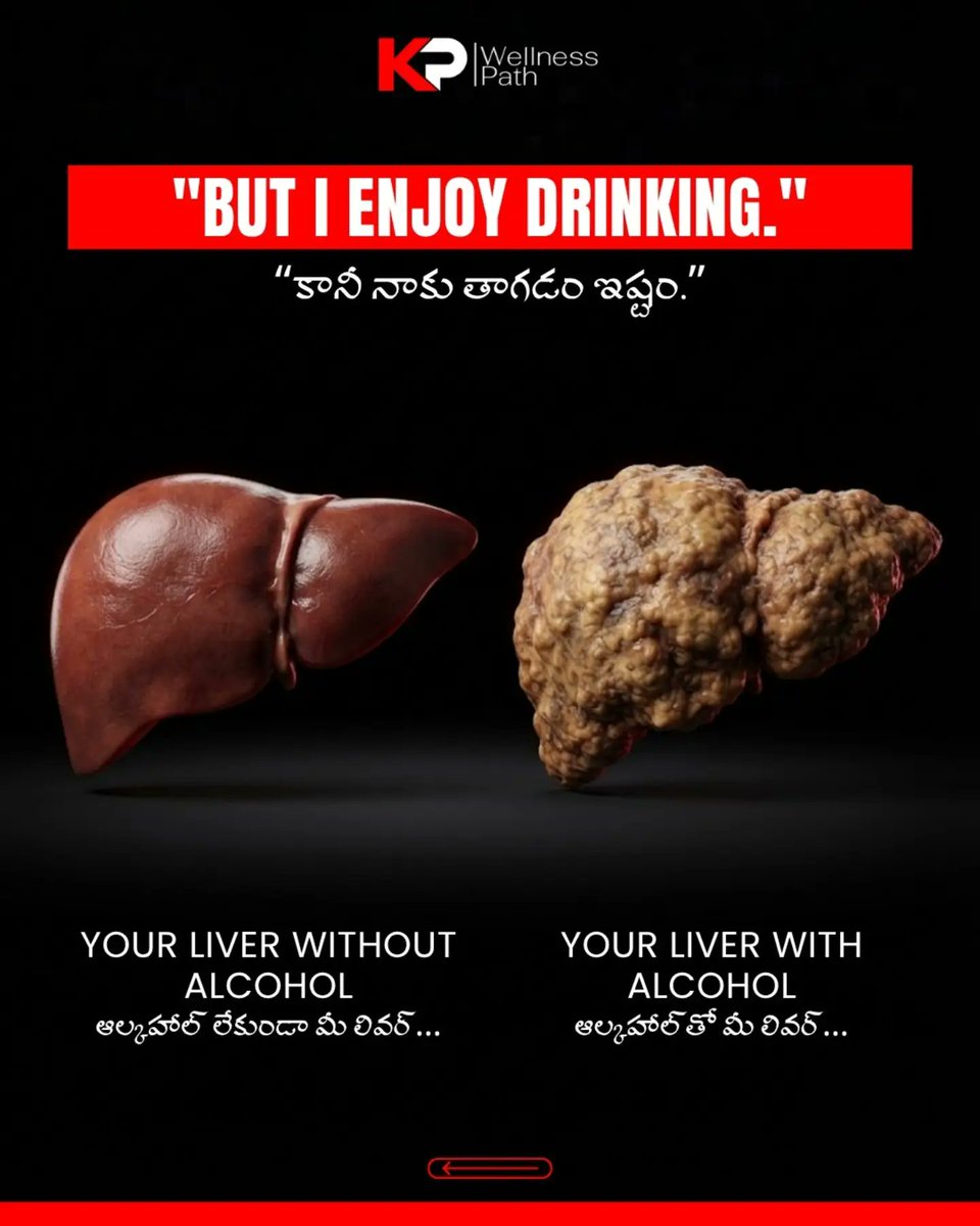 RamonaEnsworth's tweet photo. ALCOHOL &amp; YOUR BODY: THE EFFECTS MAY GO BEYOND WHAT YOU CAN SEE

Even occasional drinking can affect vital organs and systems, including the liver, brain, heart, kidneys, skin and digestive system. Understanding these effects matters for your https://t.co/IfDKKF8OXx