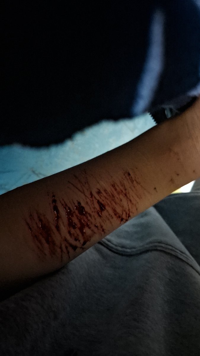 kyledotrpm's tweet photo. this is the fakest fake sfx makeup ever https://t.co/uro38yk5nM