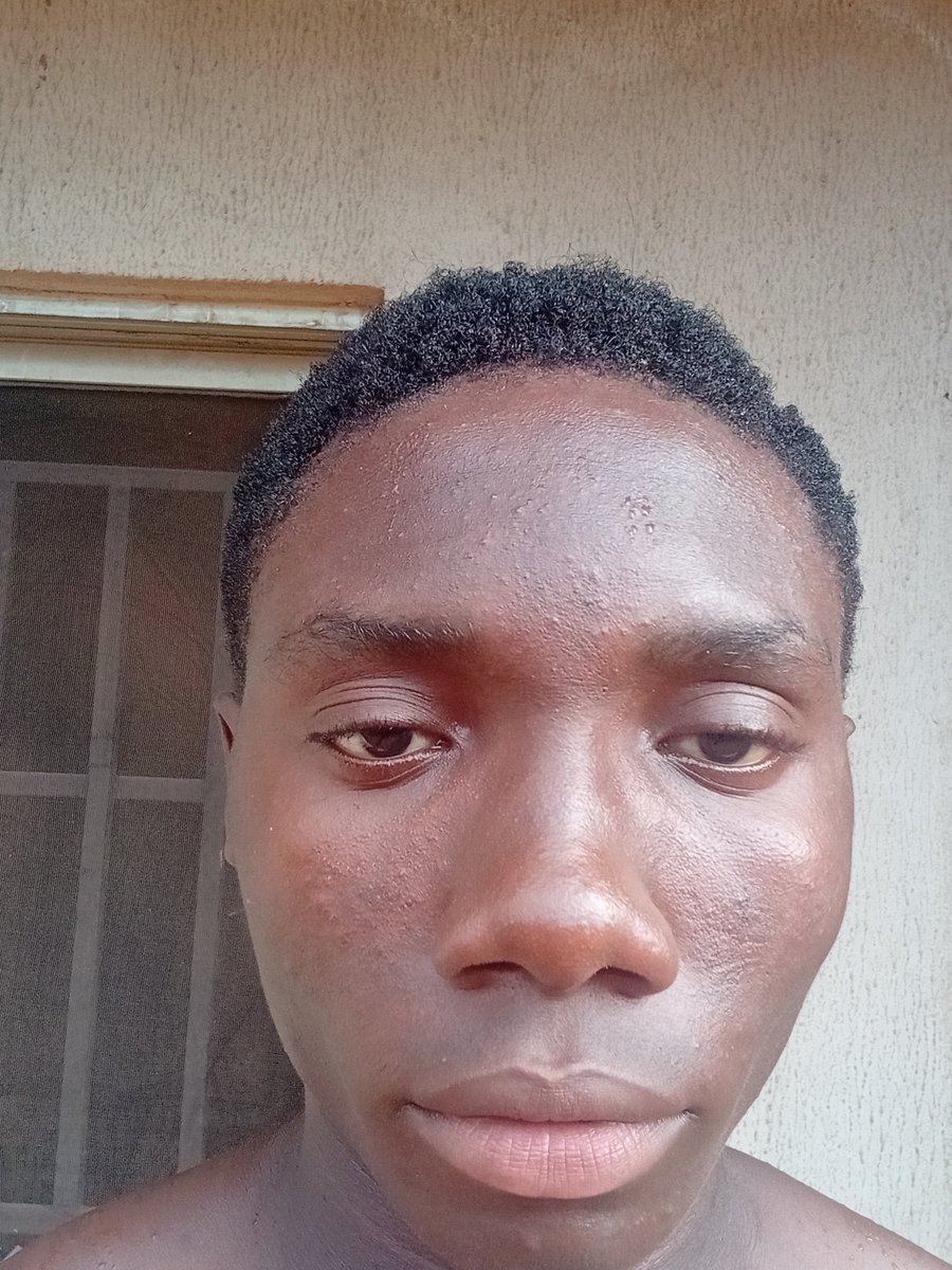 ikechukwu012006's tweet photo. Moisturises and gives your skin firmness my ass 😭😭😭💔
Before.                                After https://t.co/Vy49HwsG5D