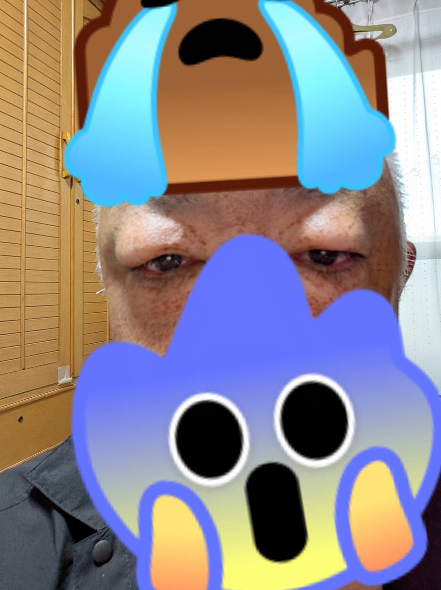 RYO_ridge's tweet photo. 実は昨日起きたら、目がめちゃくちゃ腫れ上がっていました・・・😓
何なんだろうか
何か昨日は、疲れ果てて、力尽きて寝たのが問題だったのだろうか😓
泣いても無いのになぁ
今日55歳になったのに😭 https://t.co/iaYsPBKbtB