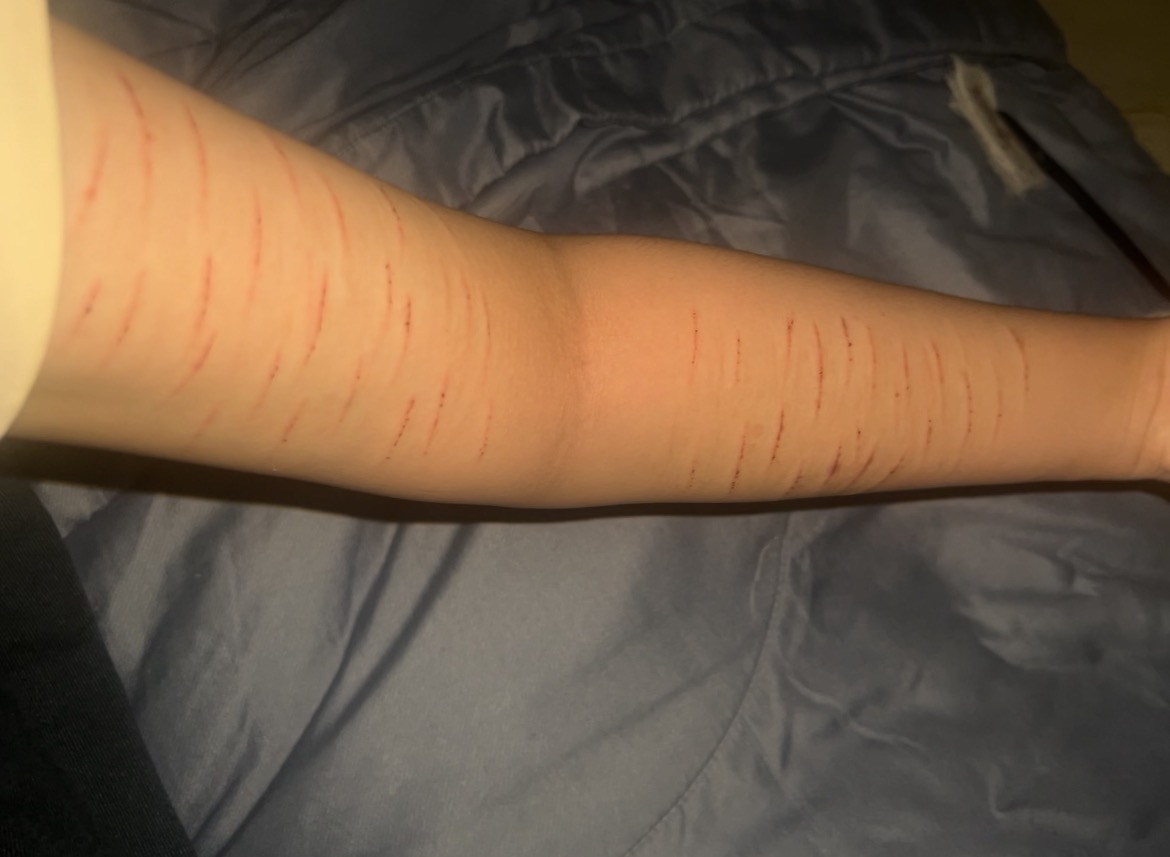 tw0tpoty0yle's tweet photo. i wiped all the bloods off SFX MAKE UP #shtwt #shedtwt https://t.co/tlYJKdKmNb
