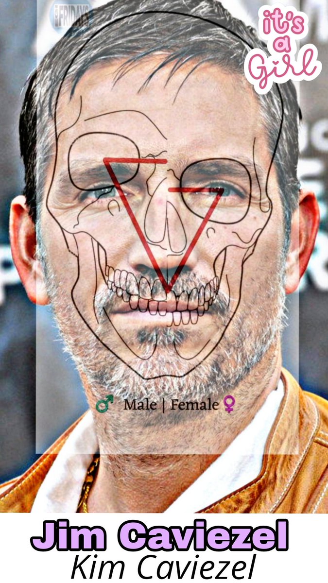 Brian_Awakened1's tweet photo. Jim Caviezel & her beast of a husband Kerri Browitt Caviezel (looks like if Adam Sandler was an actual male ๐) Neck scarring clearly visible on Jim #egi #JimCaviezel #InvertedCouples #ItsAllOfThem https://t.co/8vH3riC9bF