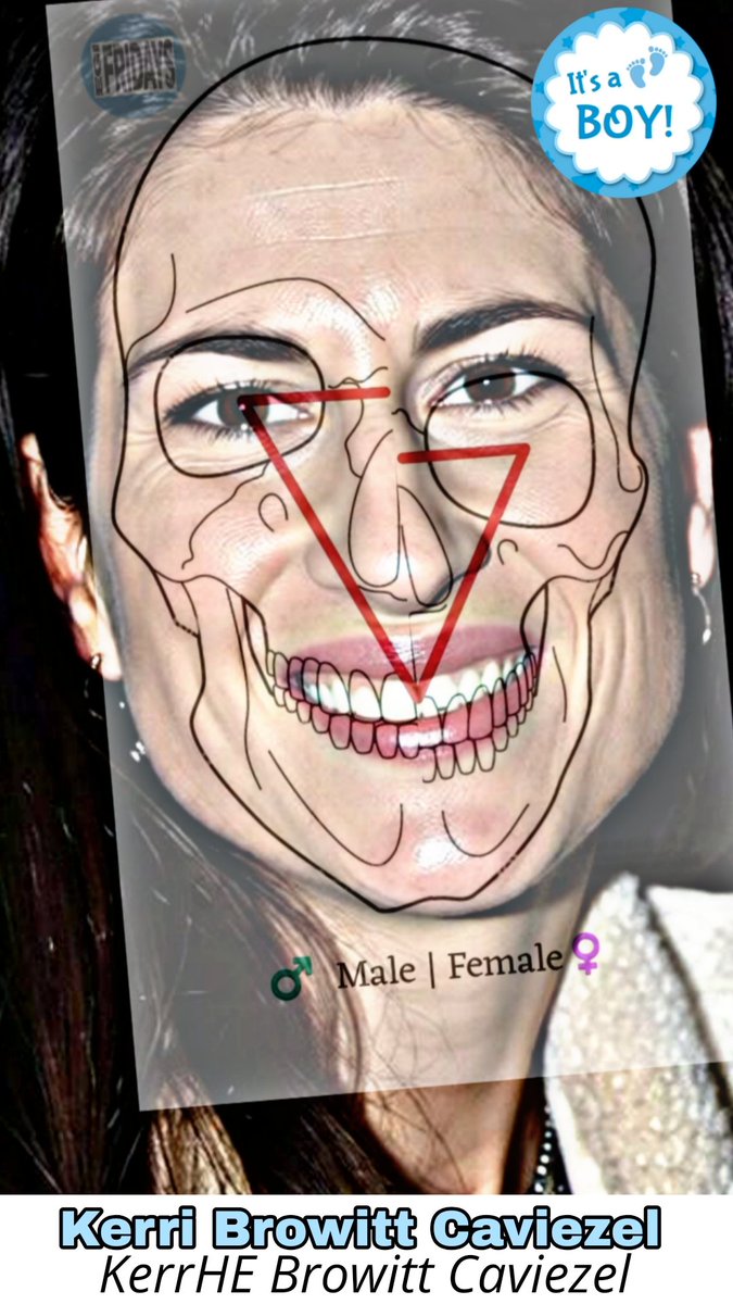 Brian_Awakened1's tweet photo. Jim Caviezel & her beast of a husband Kerri Browitt Caviezel (looks like if Adam Sandler was an actual male ๐) Neck scarring clearly visible on Jim #egi #JimCaviezel #InvertedCouples #ItsAllOfThem https://t.co/8vH3riC9bF