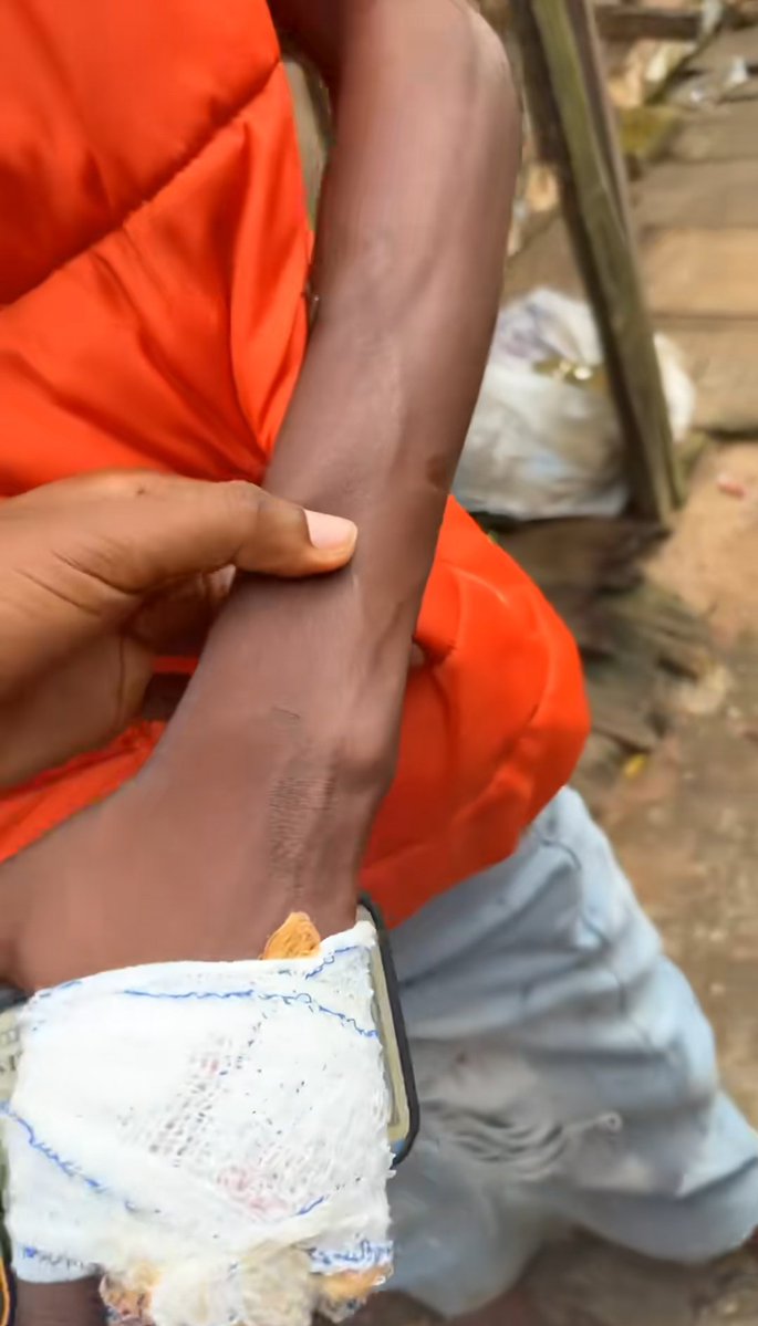 willinilli024's tweet photo. This niqqa spend millions open shop for him babe and after few months, dem broke up. Baba go the shop go collect key to the shop, naso this bannie go call her brothers come.

Dem beat shege comot from him body with him friend wey wan side am😭😭😭 His friend even got injured and he is hospitalized atm