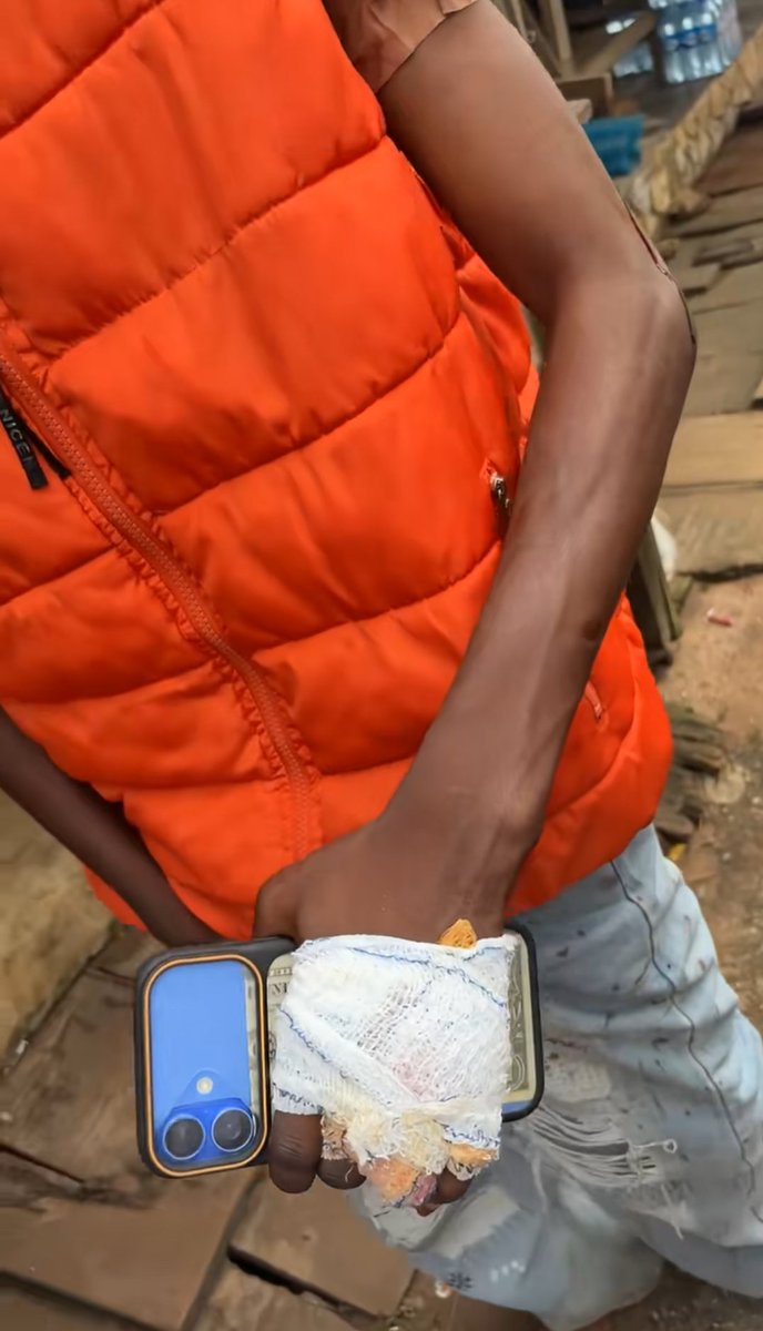 willinilli024's tweet photo. This niqqa spend millions open shop for him babe and after few months, dem broke up. Baba go the shop go collect key to the shop, naso this bannie go call her brothers come.

Dem beat shege comot from him body with him friend wey wan side am😭😭😭 His friend even got injured and he is hospitalized atm
