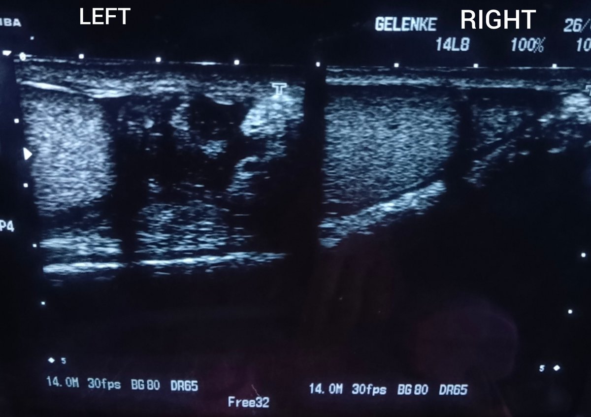 ChroRadGirlie's tweet photo. Right is normal, left is abnormal. 

Spot diagnosis📍 https://t.co/Km2nnwMoeN