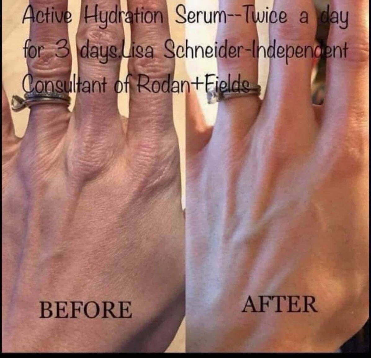 CyrusComeguooc's tweet photo. Want to say goodbye to dry skin and stay hydrated all day? Active Hydration Serum is the answer and one of my all-time favorite products. Moisturizers seal in moisture, while this serum adds water to the skin. Every skin type needs hydration. It https://t.co/leRDhVkmiL