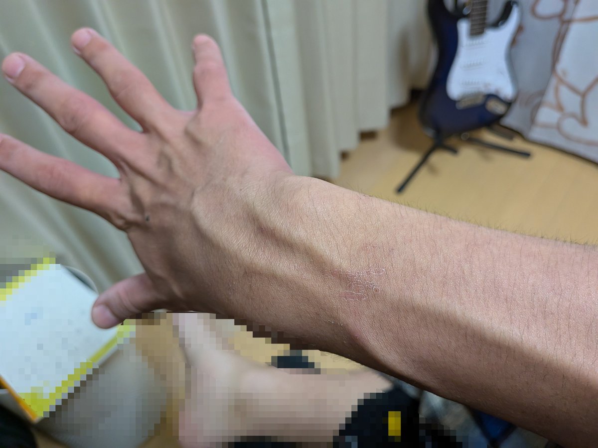 ryuukoumigimimi's tweet photo. 腕 https://t.co/yb2Ir0pcvt