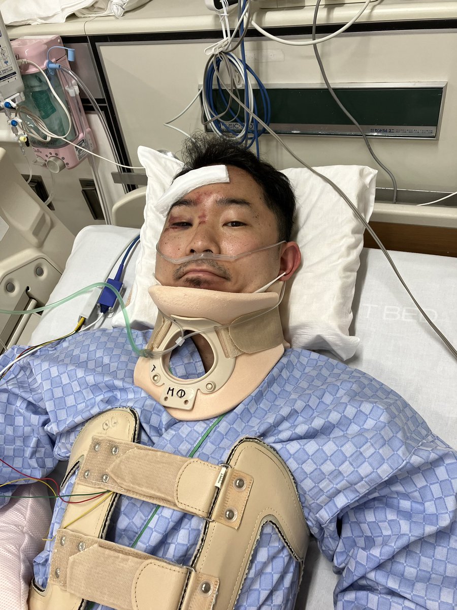 kiyo_shit's tweet photo. 4月末のバイク事故からそろそろ5ヶ月
思い通りに動かない身体を認めたくないと思いつつ
なるべく気持ちを前向きに。
趣味が多く、生きてて良かった。と思える事が多くて助かってる。 https://t.co/Lxf4rVWbzq