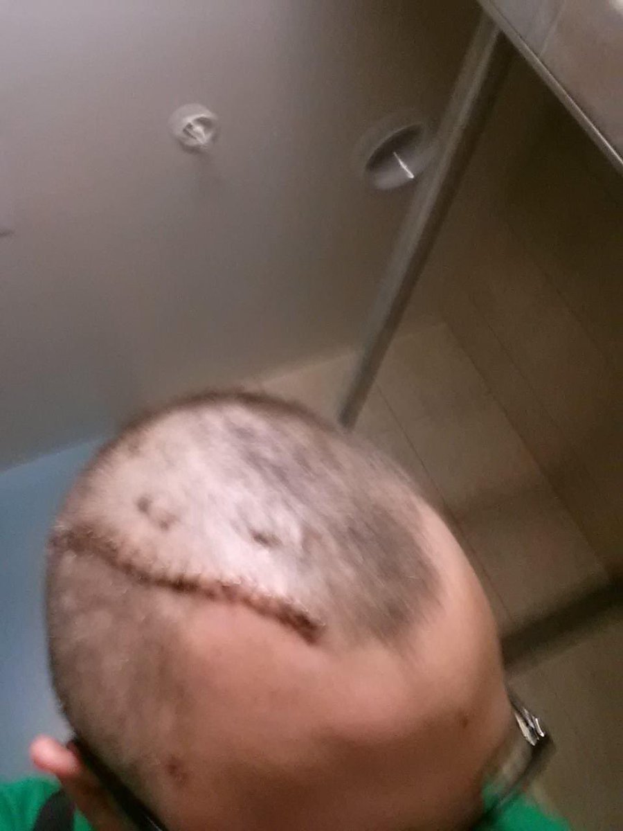 TomManson0rtq's tweet photo. @GETBrainTrust @Boxy_FT ^Source: nondriving accident survivor (who trusts our government so little I STILL went in person to vote in 2020. https://t.co/D7BHQ7oRzQ