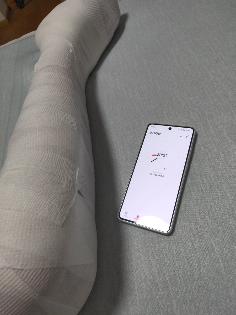 Doug_ing's tweet photo. 用了两个小时完成睡觉前的��备  腿单独包了两层绷带然后用绷带包一起，第三层保鲜膜，第四层胶带第五层保鲜膜，现在腿就和一个铁棍一样安全感满满 https://t.co/zrzr6xyX9N