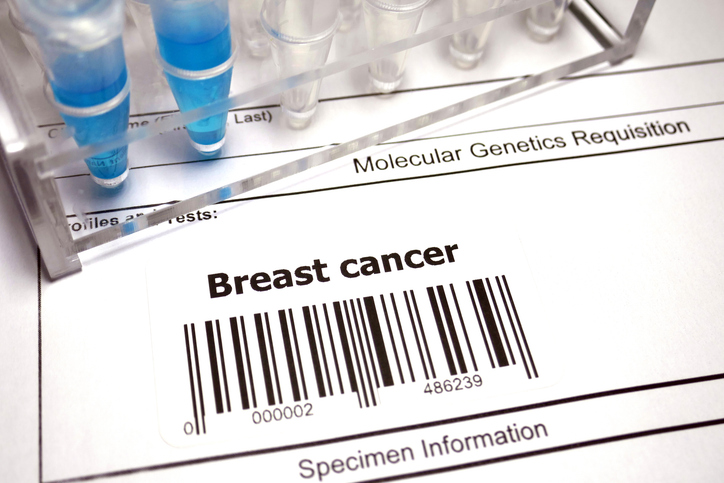 ASCOPost's tweet photo. 🧬 CAP (@Pathologists) has updated 14 Cancer Protocols to reflect advances in #precisiononcology and evolving @WHO classifications, including changes to #BreastCancer biomarker reporting and molecular testing for GIST. 

Learn more about the updates ➡️ https://t.co/9DJzh181XL https://t.co/l6CtM2RwSB