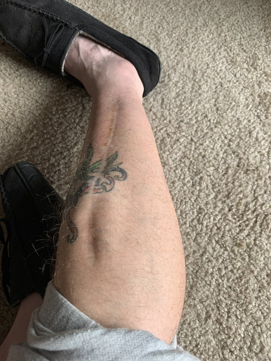 TomManson0rtq's tweet photo. @LeEpicBooch @CarcinogenLG @GETBrainTrust @Boxy_FT Also got lucky twice but almost a double amputee too. Still walked in person to show mine in 2020(that's how little I trust our government.) https://t.co/TUwRQwlFe1