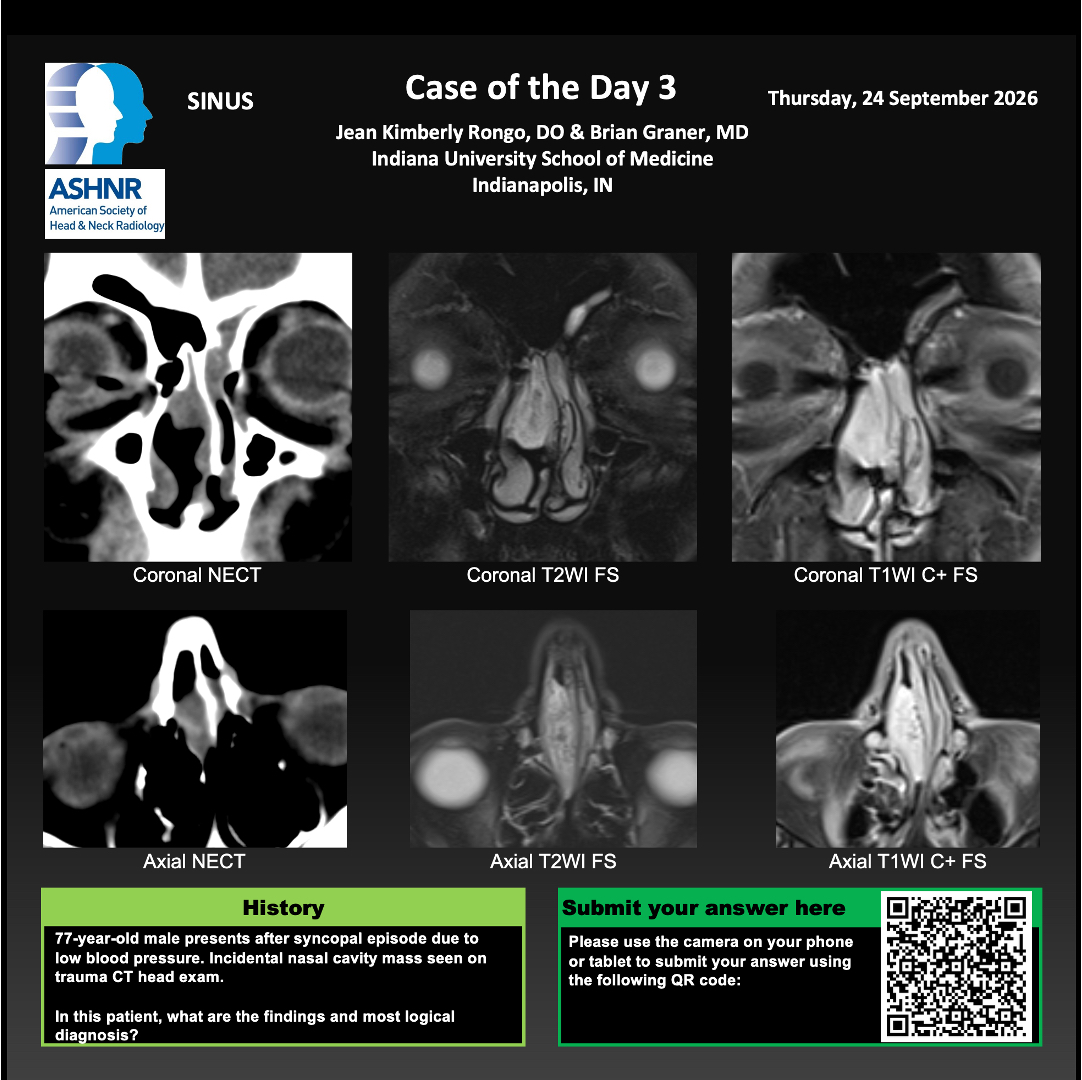 ASHNRSociety's tweet photo. Thanks to our day 2 Case of the Day presenters for sharing these fantastic cases! #ASHNR26 https://t.co/ZuCsLraxvg