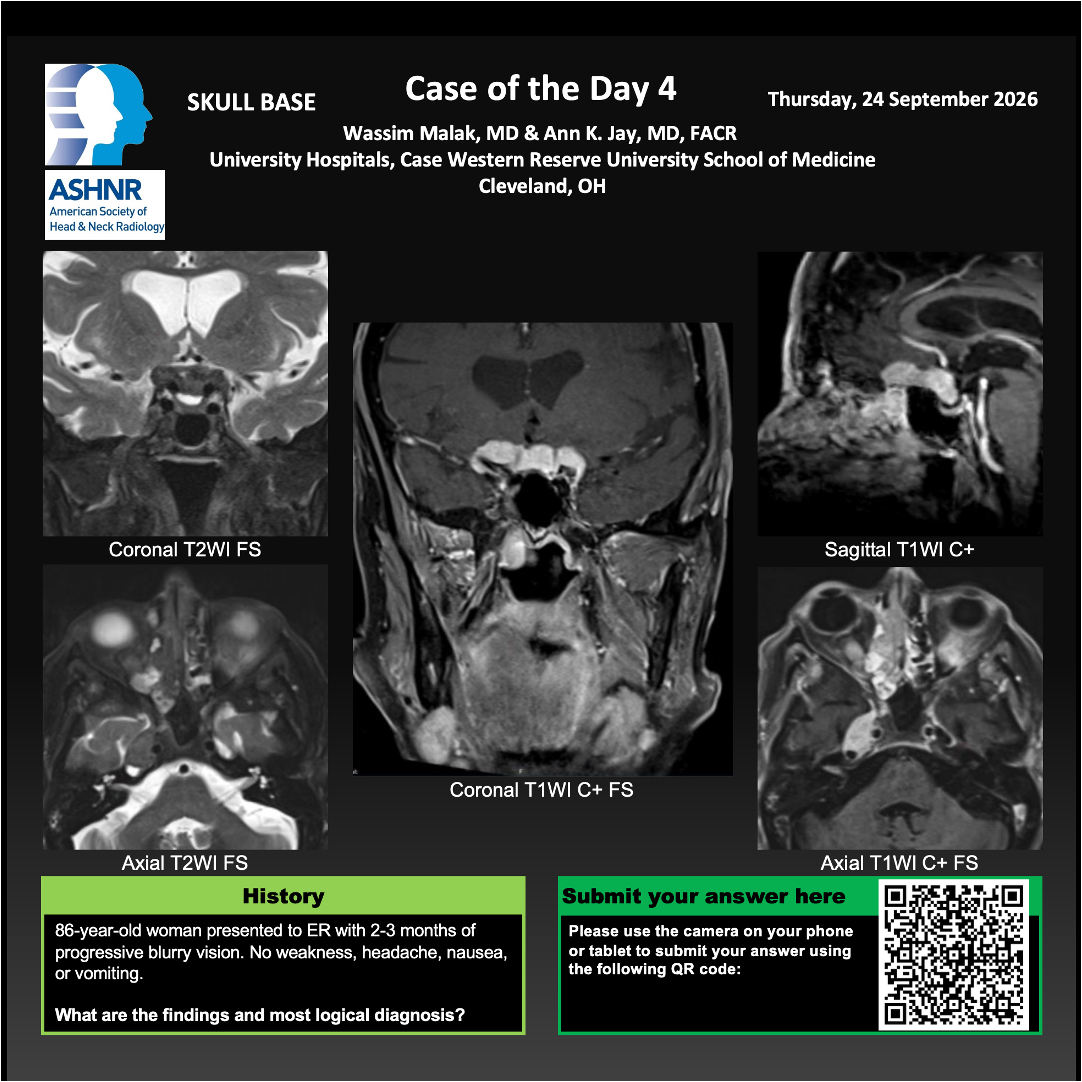 ASHNRSociety's tweet photo. Thanks to our day 2 Case of the Day presenters for sharing these fantastic cases! #ASHNR26 https://t.co/ZuCsLraxvg