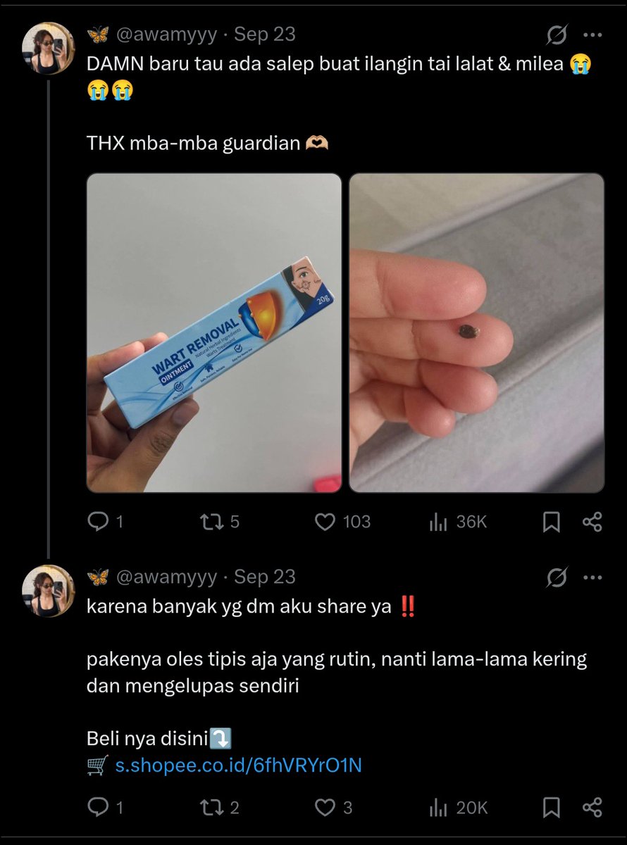 sayapapao's tweet photo. @dontfindmenow Kayaknya iya deh dia bukan real account. You cant tell me the hand of the left sama yang di kanan are from the same person. Struktur tangan dan kuku nya beda https://t.co/vQSPdmWFJz