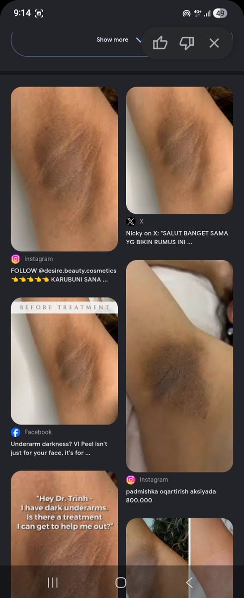 sayapapao's tweet photo. @dontfindmenow Gw coba reverse search image di Google, yg foto kiri itu ambil dari internet. Bukan real pic punya dia

Lagian

1. Foto kiri itu resolusinya jelek banget. Beda sama foto kanan
2. Struktur ketek kiri kanan juga beda https://t.co/o3ifJ4a6Vq