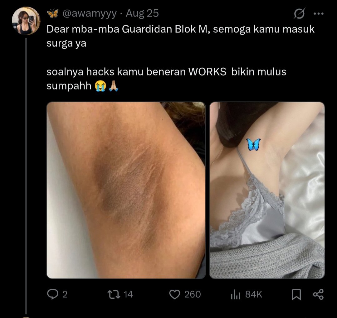 sayapapao's tweet photo. @dontfindmenow Gw coba reverse search image di Google, yg foto kiri itu ambil dari internet. Bukan real pic punya dia

Lagian

1. Foto kiri itu resolusinya jelek banget. Beda sama foto kanan
2. Struktur ketek kiri kanan juga beda https://t.co/o3ifJ4a6Vq