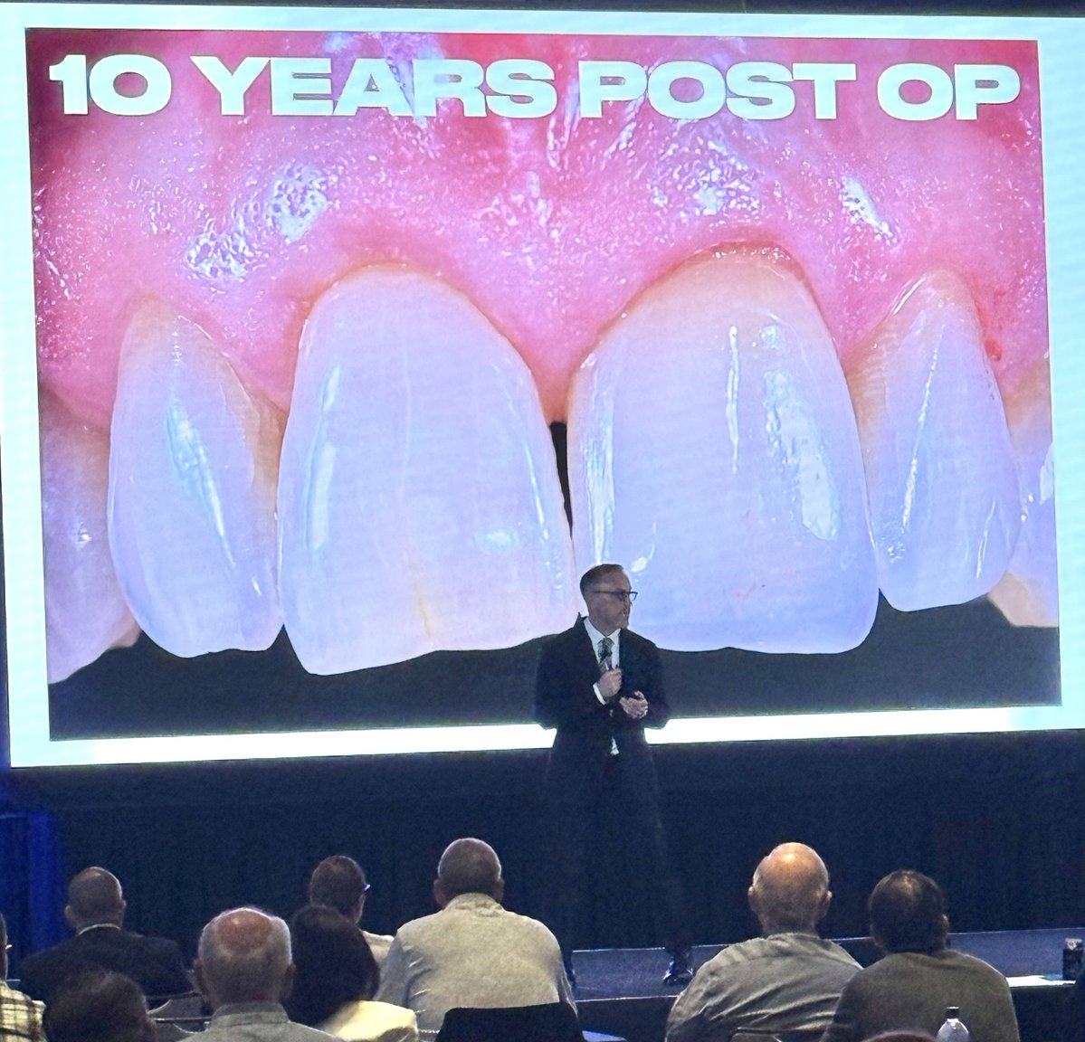 DeutscheDT's tweet photo. Prof. Howard Gluckman — Partial Extraction Therapy pioneer, IAA director, UPenn Periodontics adjunct — showing 10-year post-op results at the Pikos Symposium 2026. 🦷 Shop his curated instrument collection: https://t.co/gYWD3YtLwC #PikosSymposium #DentalImplants https://t.co/ZfYEV5ez1j