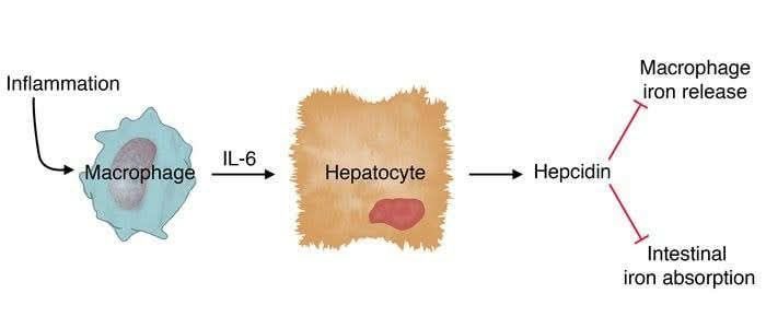 laboratorykh's tweet photo. Hepcidin🔬 

📌 من المعلومات المهمة في Hematology

🧬 ما هو Hepcidin؟

هو هرمون ببتيدي مكوّن من 25 حمضًا أمينيًا، يُنتَج بشكل رئيسي في الكبد، ويُعد من Positive Acute-Phase Proteins وأحد أهم المنظمات لمستوى الحديد في الجسم

⚙️ ما وظيفته؟

يعمل Hepcidin على تثبيط Ferroportin، وهو البروتين المسؤول عن إخراج الحديد إلى الدم من:

🔹 خلايا الأمعاء
🔹 Macrophages
🔹 Hepatocytes

عندما يرتبط Hepcidin بـ Ferroportin يؤدي إلى دخوله للخلية وتحلله، وبالتالي ↓ خروج الحديد إلى الدم. 

🔥 علاقته بـ Anemia of chronic disease 🩸

في حالات Chronic Inflammation يرتفع IL-6 → يحفّز الكبد على زيادة إنتاج Hepcidin → ↓ Ferroportin → احتجاز الحديد داخل الـMacrophages وانخفاض امتصاص الحديد من الأمعاء.

⬇️ Serum Iron
⬇️ Iron availability for erythropoiesis
⬆️ Ferritin

وهذا أحد أهم الآليات التي تؤدي إلى Anemia of Chronic Disease / Anemia of Inflammation؛ أي أن الحديد موجود في الجسم لكن غير متاح بشكل كافٍ لنخاع العظم

⭐ احفظها للـSLLE:

Inflammation → IL-6 ↑ → Hepcidin ↑ → Ferroportin ↓ → Iron sequestration → 
Serum Iron ↓ → ACD

#مختبرات_طبيه
#hematology