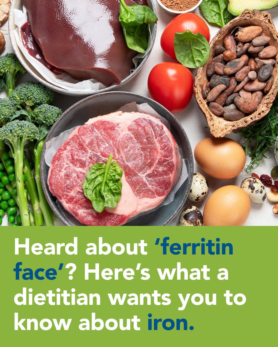 MUSChealth's tweet photo. Heard of “ferritin face”? Low iron can cause symptoms including fatigue, dizziness, feeling cold and pale skin, but social media trends aren’t a diagnosis.

MUSC Health registered dietitian Alaine Mills explains what to know about ferritin and iron:
https://t.co/7Kgr778OkT https://t.co/i02uWrk3Gn