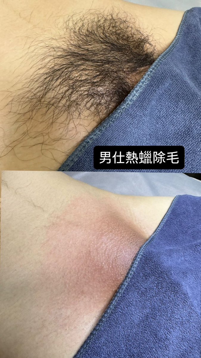 Zhen1103_'s tweet photo. 內埔男仕除毛 https://t.co/4gdIQX9Iu0