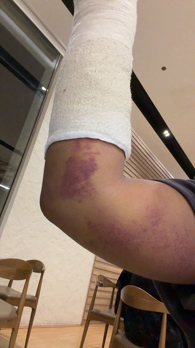 8___ti's tweet photo. ماهيب دايم يالسنافي عوافي https://t.co/bHNOGIWnxB