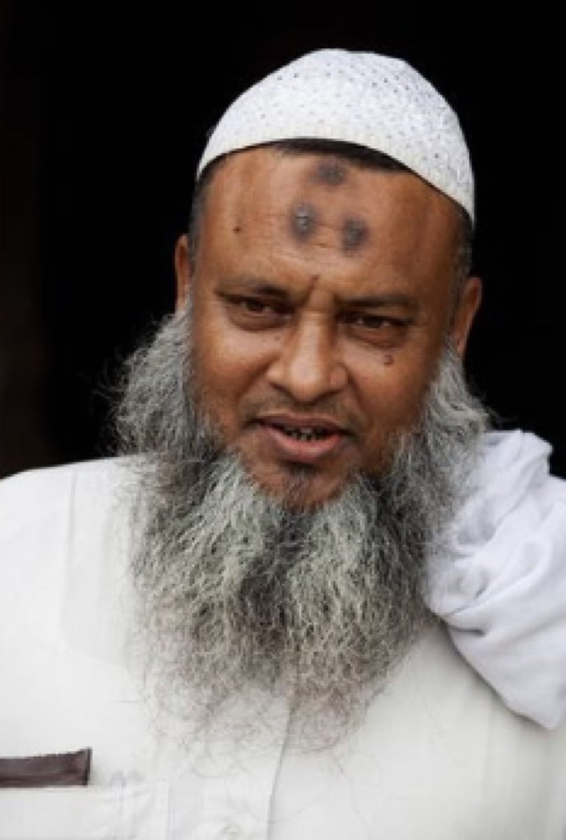 realMaalouf's tweet photo. The mark of prostration among Muslims.

You've probably already noticed that some Muslim men have a disgusting mark (sometimes several) on their forehead.

This mark is called zabiba ("raisin") because of its appearance.

It’s a callus or bump that develops from the repeated friction of the skin against the floor or the prayer rug.

It’s one of the biggest signs of extremism. Even in the Muslim world, it’s associated with terrorism.

Be careful around those who have it.