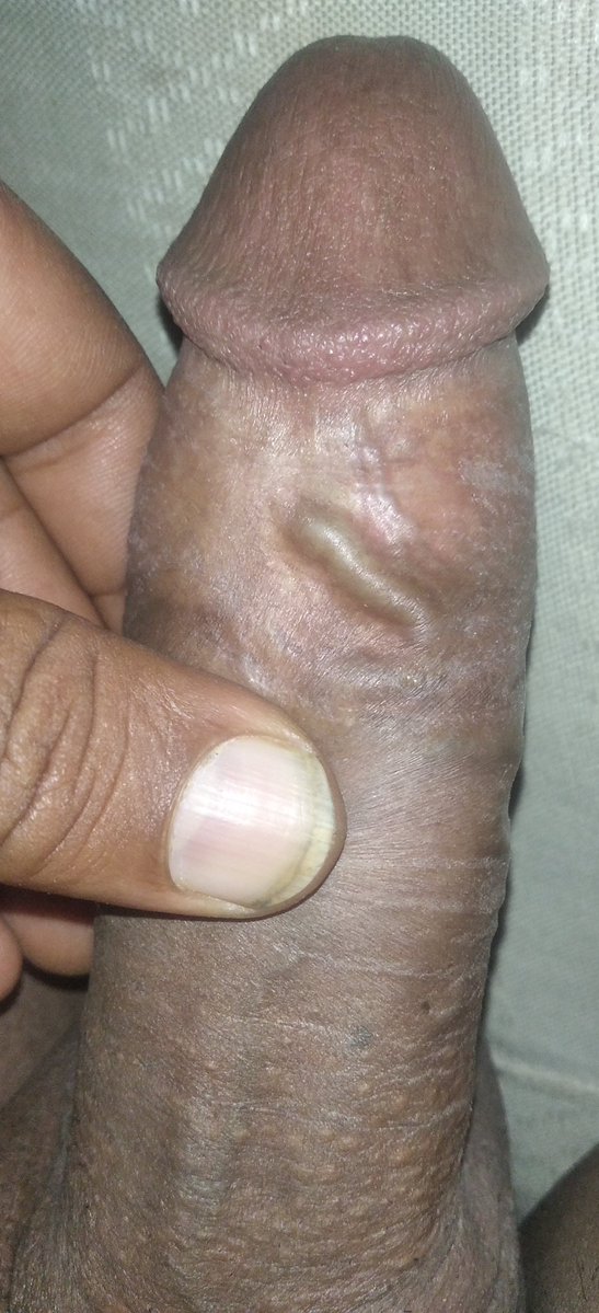 BdalLym9170's tweet photo. @GloriaSolobg 🥵🔥🥵😘🥵🔥🥵🔥 https://t.co/CN3IJEA7ep