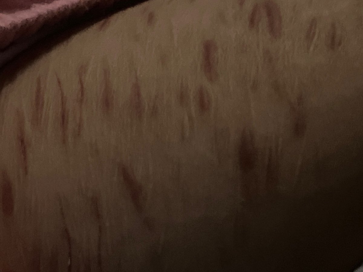 valeektn's tweet photo. cicatrices
#shtwt #IA #suicidetwt #fakemakeup https://t.co/F9XH4CN7aR