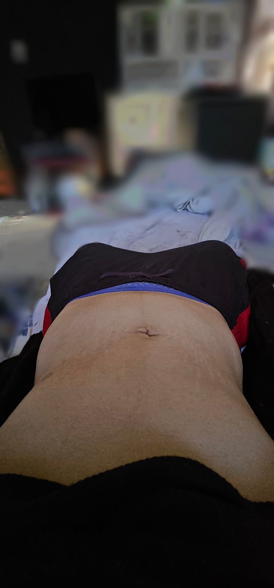 Adrianne2rfd's tweet photo. Today's body check
#shedrtwt #edrtwt #editwt #ricecaketwt https://t.co/VNtIsPm1SQ
