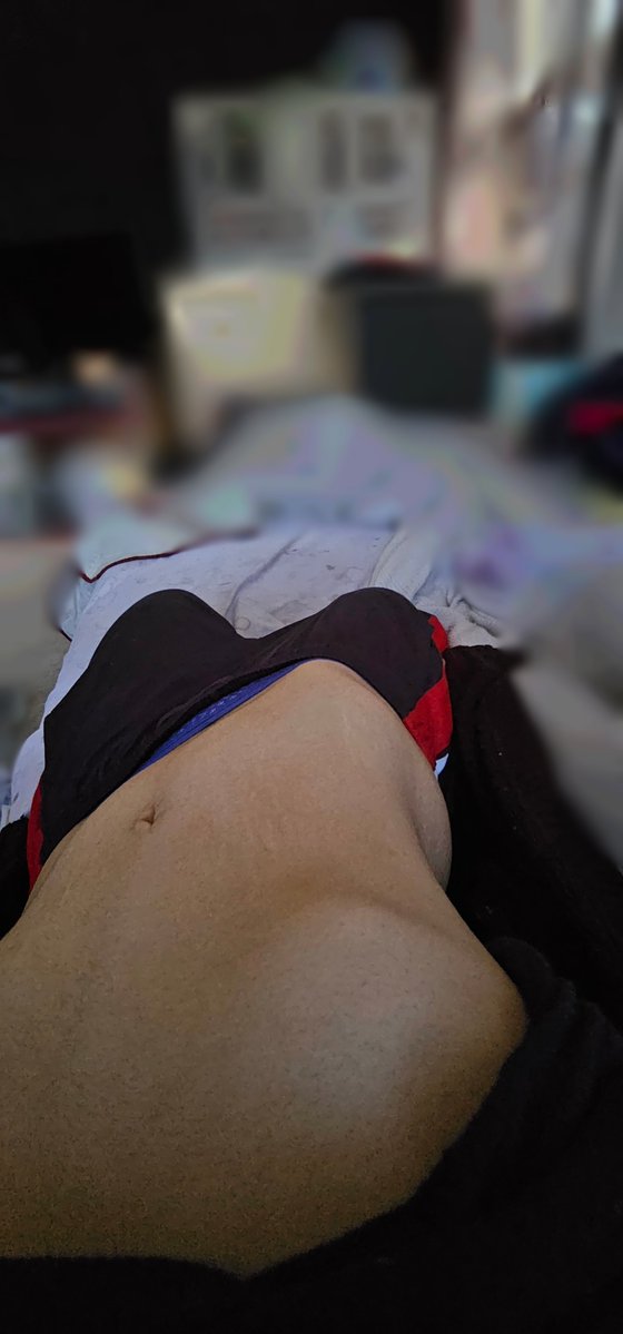 Adrianne2rfd's tweet photo. Today's body check
#shedrtwt #edrtwt #editwt #ricecaketwt https://t.co/VNtIsPm1SQ